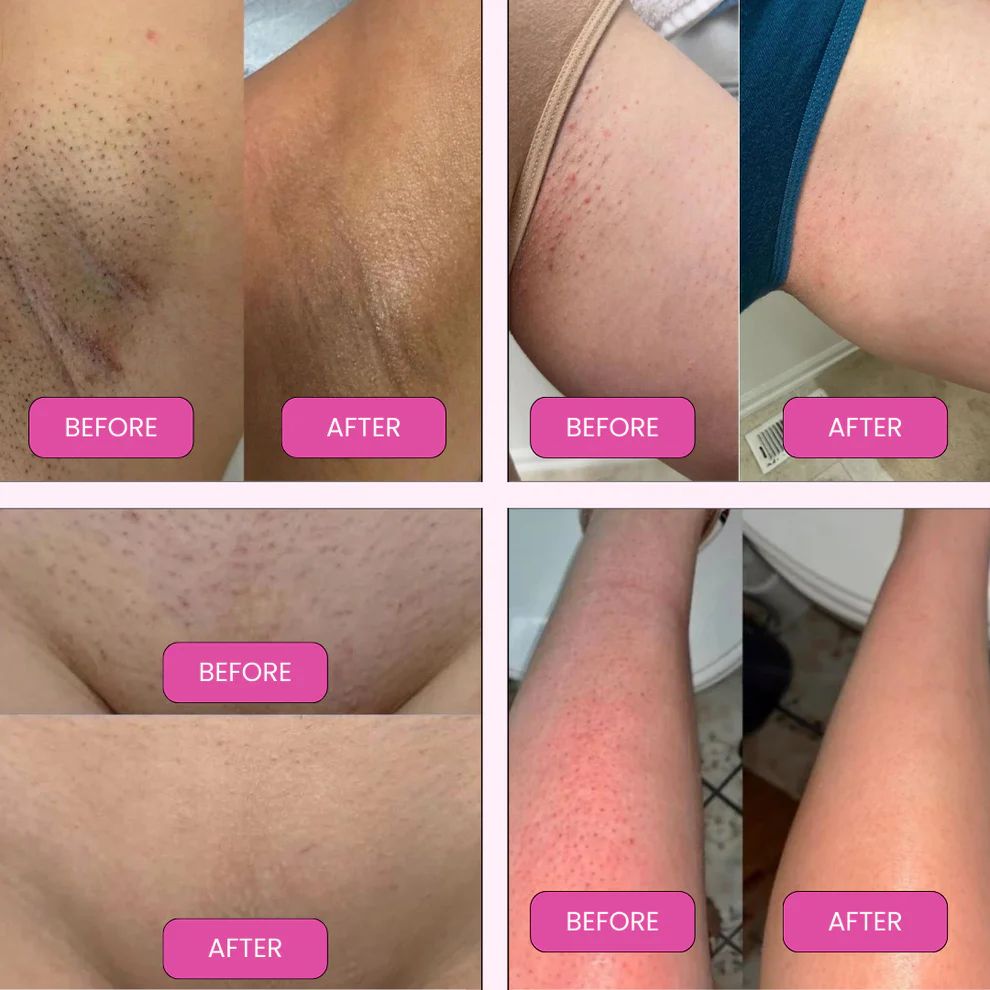 🪒2 in 1 Electric Shaver Razors for Women✨ - Image 7