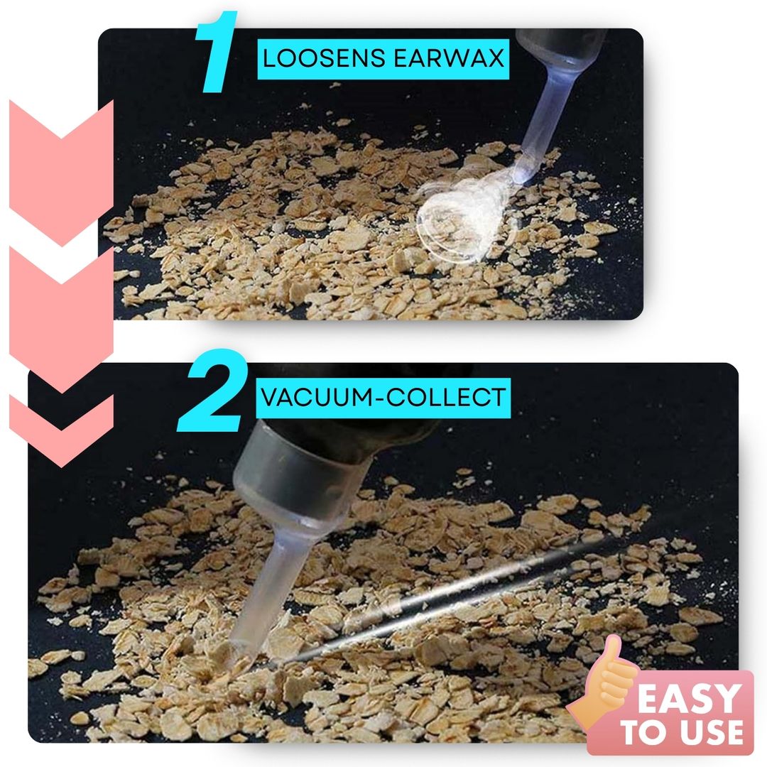Hot Sale Earwax Vacuum Safe Painless Ear Cleaning for the Whole Family - Image 3