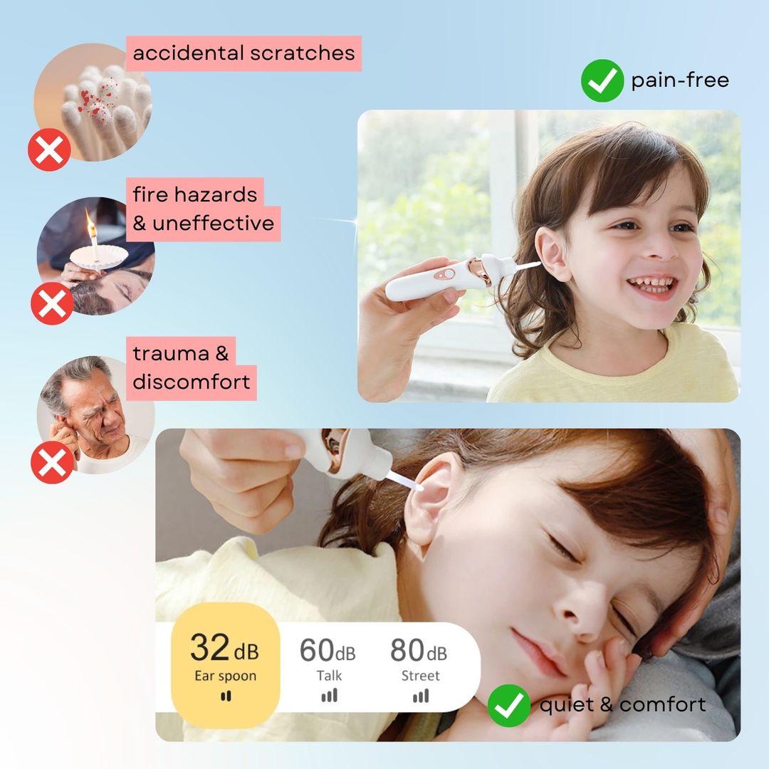 Hot Sale Earwax Vacuum Safe Painless Ear Cleaning for the Whole Family - Image 8